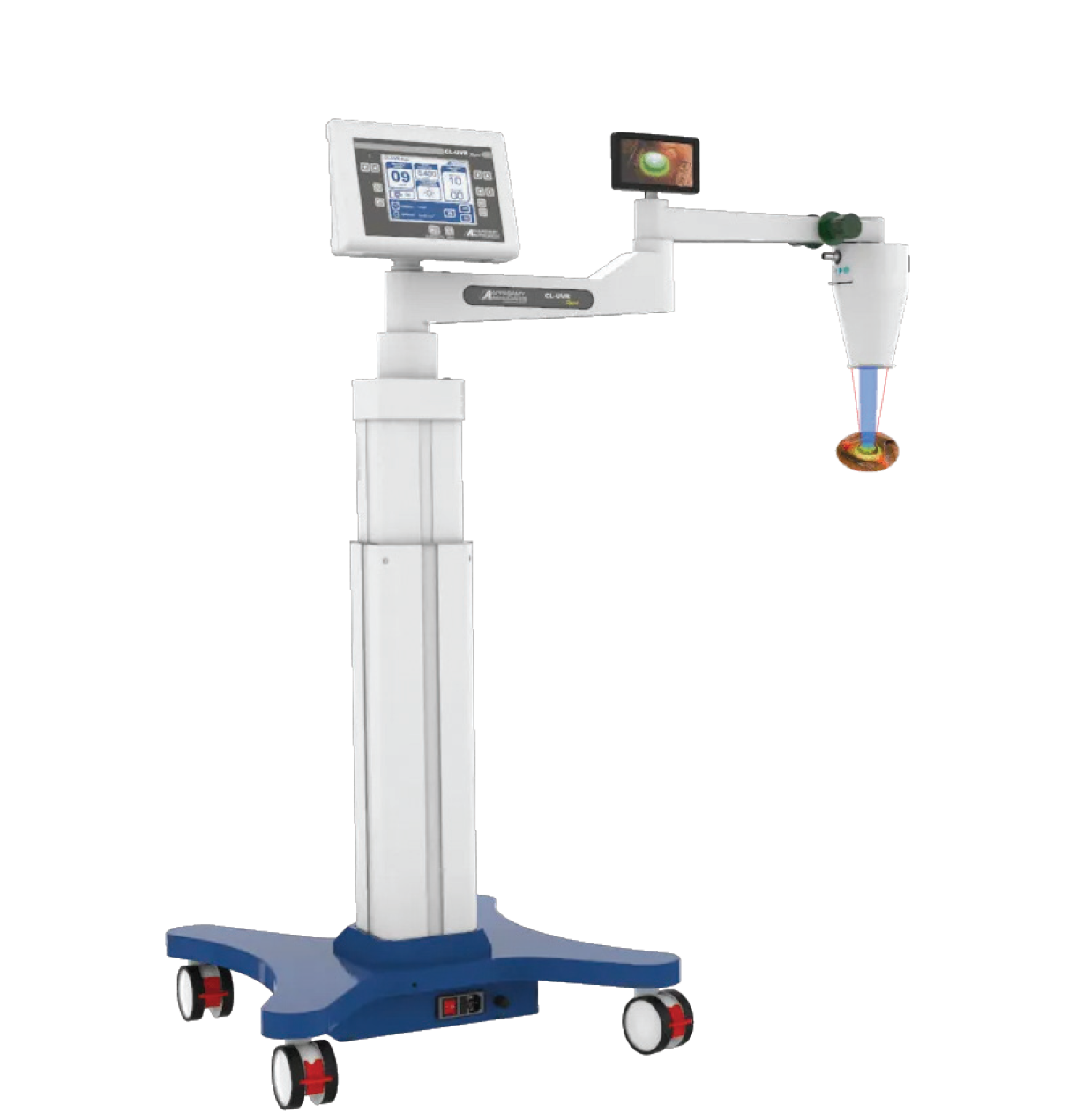 Corneal Cross-Linking (CL-UVR Rapid)